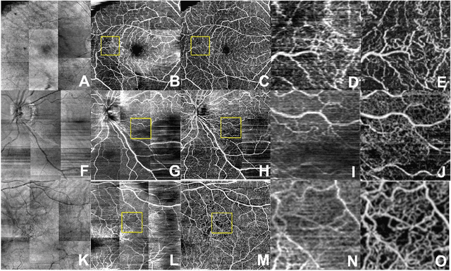 Figure 4 for Generating retinal flow maps from structural optical coherence tomography with artificial intelligence