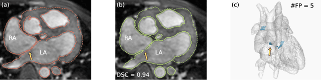 Figure 1 for Topology-preserving augmentation for CNN-based segmentation of congenital heart defects from 3D paediatric CMR