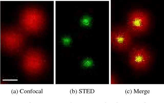 Figure 1 for Learning to Become an Expert: Deep Networks Applied To Super-Resolution Microscopy