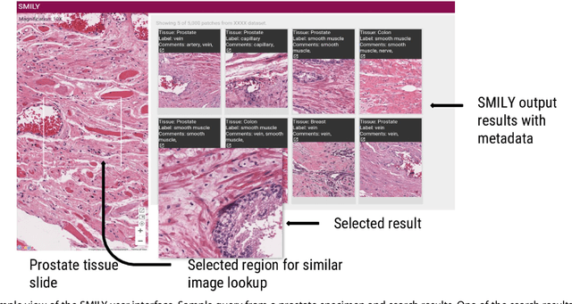Figure 3 for Similar Image Search for Histopathology: SMILY