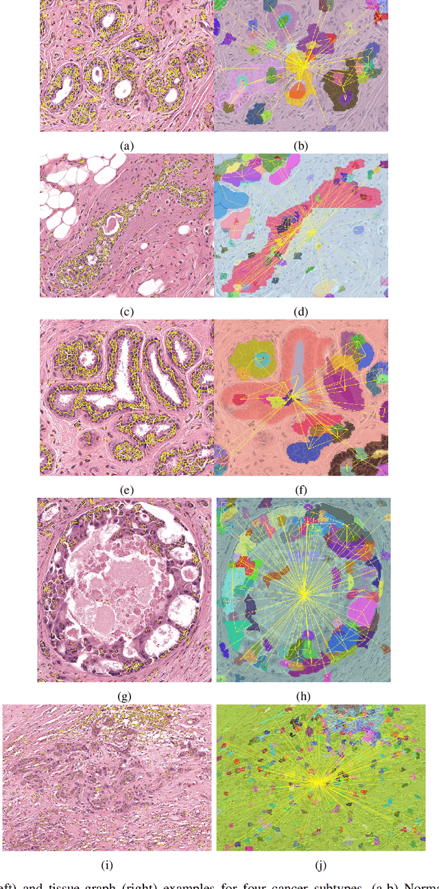 Figure 3 for HACT-Net: A Hierarchical Cell-to-Tissue Graph Neural Network for Histopathological Image Classification