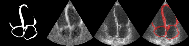 Figure 3 for Efficient Pix2Vox++ for 3D Cardiac Reconstruction from 2D echo views