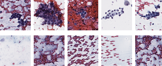 Figure 1 for Thyroid Cancer Malignancy Prediction From Whole Slide Cytopathology Images