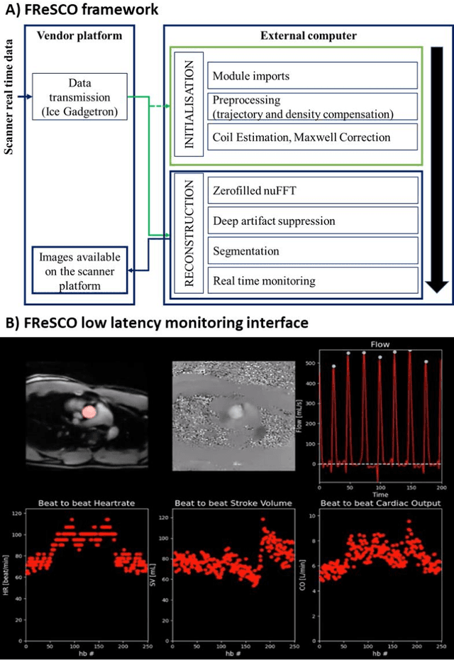 Figure 1 for FReSCO: Flow Reconstruction and Segmentation for low latency Cardiac Output monitoring using deep artifact suppression and segmentation