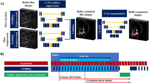 Figure 2 for FReSCO: Flow Reconstruction and Segmentation for low latency Cardiac Output monitoring using deep artifact suppression and segmentation