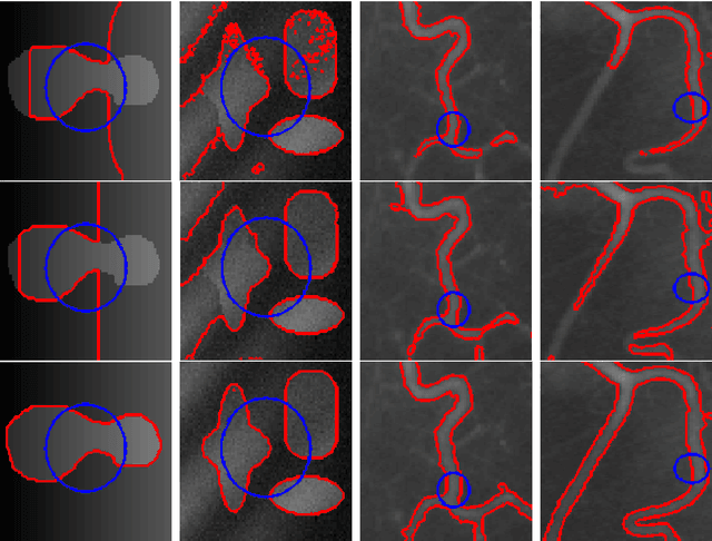 Figure 2 for A Local Active Contour Model for Image Segmentation with Intensity Inhomogeneity
