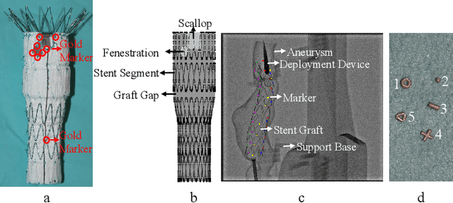 Figure 1 for Towards Automatic 3D Shape Instantiation for Deployed Stent Grafts: 2D Multiple-class and Class-imbalance Marker Segmentation with Equally-weighted Focal U-Net