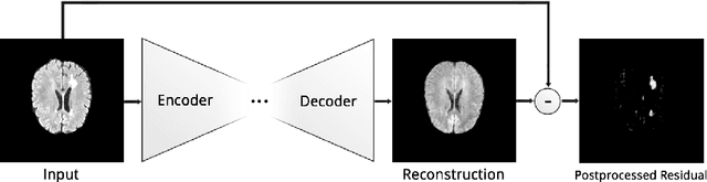 Figure 1 for Deep Autoencoding Models for Unsupervised Anomaly Segmentation in Brain MR Images