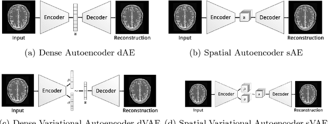 Figure 4 for Deep Autoencoding Models for Unsupervised Anomaly Segmentation in Brain MR Images