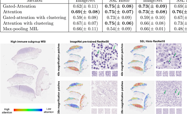 Figure 3 for Weakly-supervised learning for image-based classification of primary melanomas into genomic immune subgroups