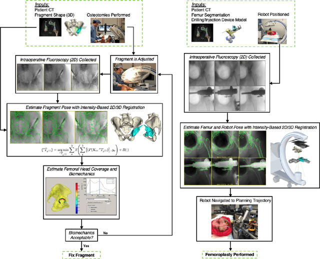 Figure 1 for The Impact of Machine Learning on 2D/3D Registration for Image-guided Interventions: A Systematic Review and Perspective