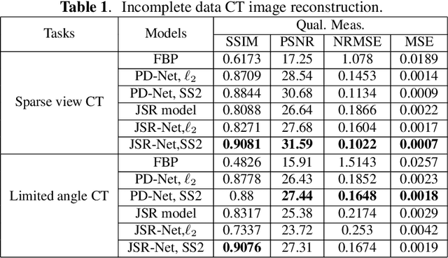 Figure 1 for JSR-Net: A Deep Network for Joint Spatial-Radon Domain CT Reconstruction from incomplete data