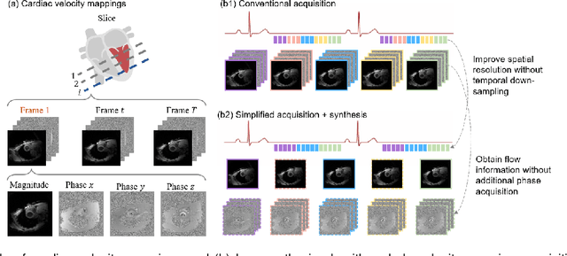 Figure 1 for HDL: Hybrid Deep Learning for the Synthesis of Myocardial Velocity Maps in Digital Twins for Cardiac Analysis