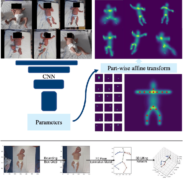 Figure 1 for Unsupervised Human Pose Estimation through Transforming Shape Templates