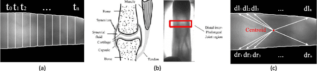 Figure 1 for From Noise to Feature: Exploiting Intensity Distribution as a Novel Soft Biometric Trait for Finger Vein Recognition