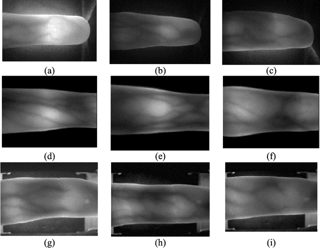 Figure 3 for From Noise to Feature: Exploiting Intensity Distribution as a Novel Soft Biometric Trait for Finger Vein Recognition