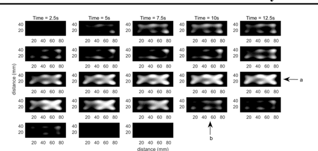 Figure 2 for Bayesian Belief Updating of Spatiotemporal Seizure Dynamics