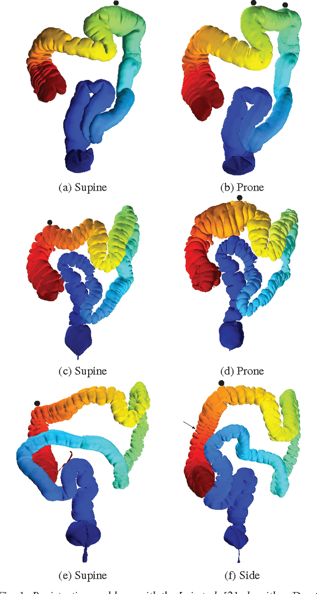Figure 1 for Corresponding Supine and Prone Colon Visualization Using Eigenfunction Analysis and Fold Modeling