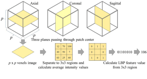 Figure 3 for 3D FCN Feature Driven Regression Forest-Based Pancreas Localization and Segmentation