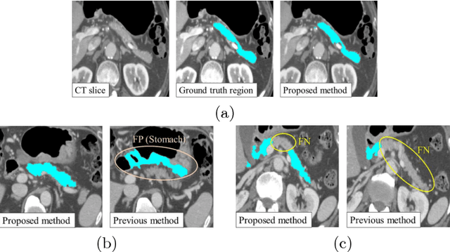Figure 4 for 3D FCN Feature Driven Regression Forest-Based Pancreas Localization and Segmentation