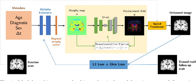 Figure 1 for Distinguishing Healthy Ageing from Dementia: a Biomechanical Simulation of Brain Atrophy using Deep Networks