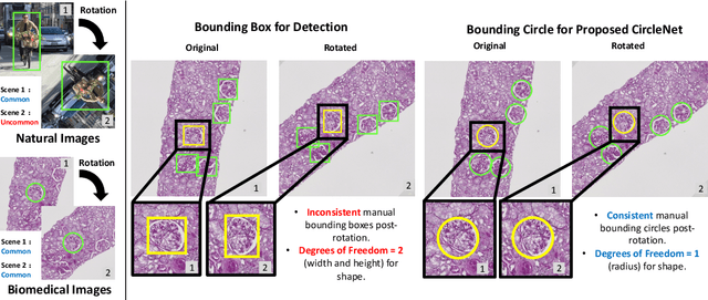 Figure 1 for Circle Representation for Medical Object Detection