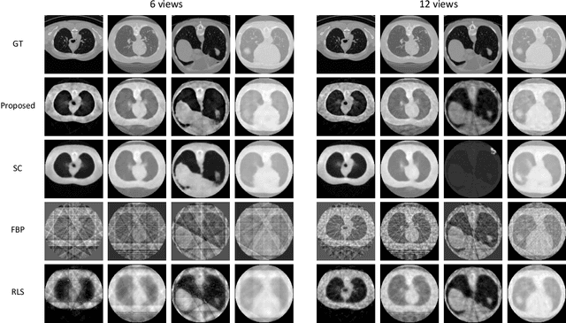 Figure 2 for Extreme Few-view CT Reconstruction using Deep Inference