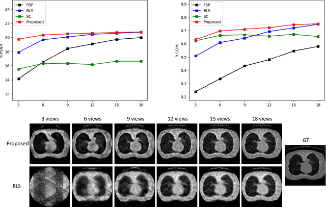 Figure 3 for Extreme Few-view CT Reconstruction using Deep Inference