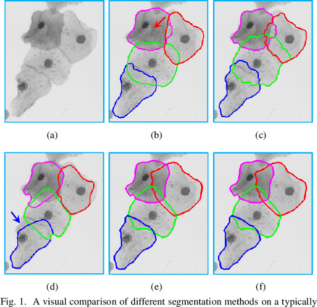 Figure 1 for Constrained Multi-shape Evolution for Overlapping Cytoplasm Segmentation