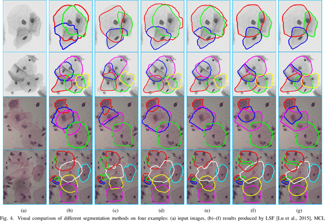 Figure 4 for Constrained Multi-shape Evolution for Overlapping Cytoplasm Segmentation