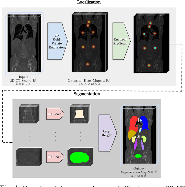 Figure 1 for A unified 3D framework for Organs at Risk Localization and Segmentation for Radiation Therapy Planning