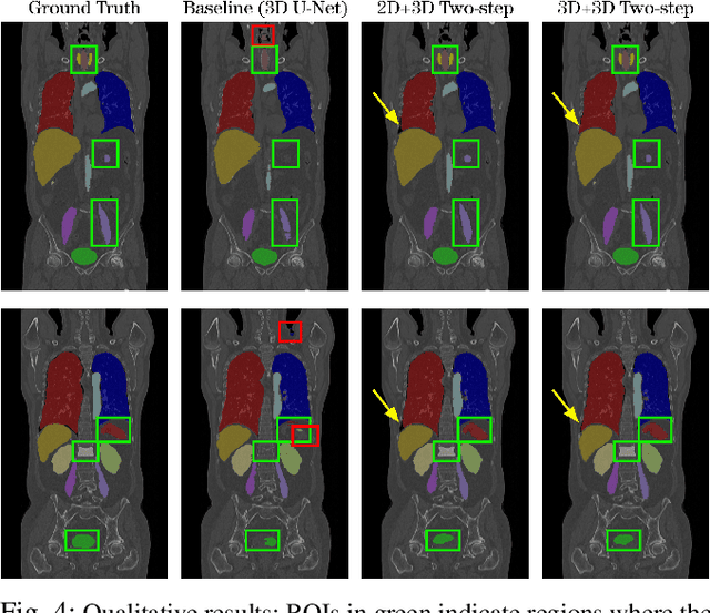 Figure 4 for A unified 3D framework for Organs at Risk Localization and Segmentation for Radiation Therapy Planning