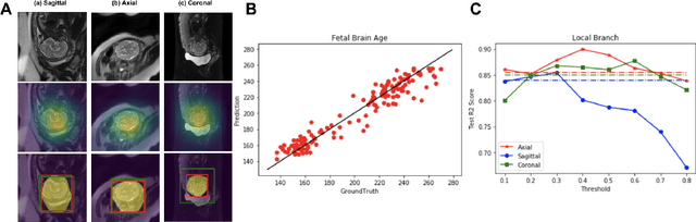 Figure 3 for Deep Learning with Attention to Predict Gestational Age of the Fetal Brain