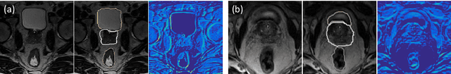 Figure 1 for Semantic-guided Encoder Feature Learning for Blurry Boundary Delineation