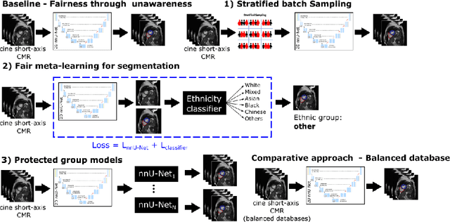 Figure 1 for Fairness in Cardiac MR Image Analysis: An Investigation of Bias Due to Data Imbalance in Deep Learning Based Segmentation