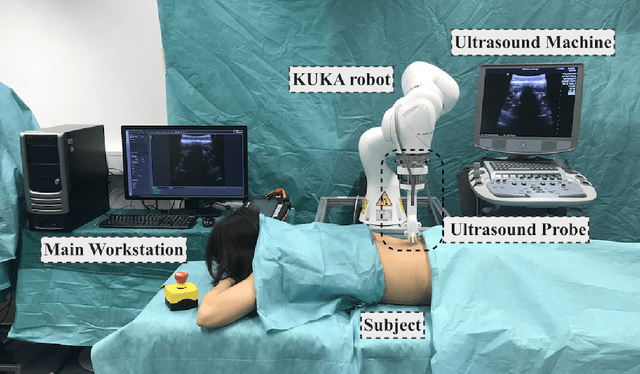 Figure 1 for Ultrasound-Guided Robotic Navigation with Deep Reinforcement Learning