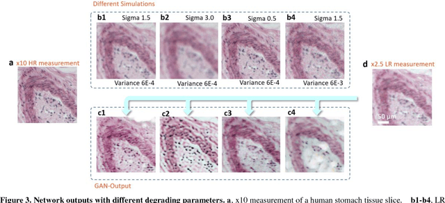 Figure 4 for High-throughput, high-resolution registration-free generated adversarial network microscopy