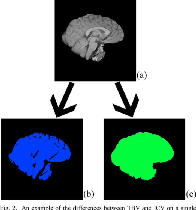 Figure 2 for Web Based Brain Volume Calculation for Magnetic Resonance Images