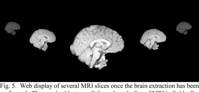 Figure 4 for Web Based Brain Volume Calculation for Magnetic Resonance Images