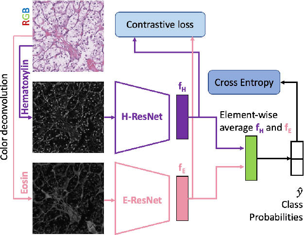 Figure 1 for Stain based contrastive co-training for histopathological image analysis