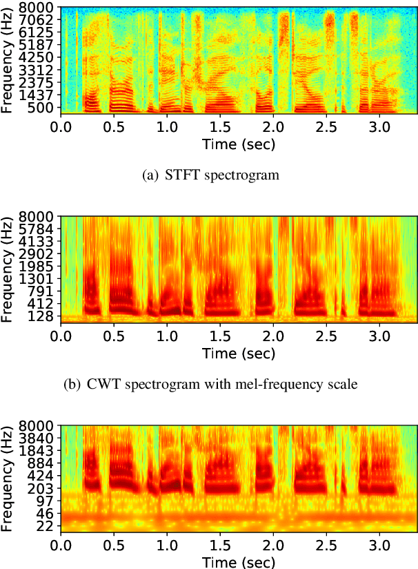 Figure 4 for Training a Neural Speech Waveform Model using Spectral Losses of Short-Time Fourier Transform and Continuous Wavelet Transform