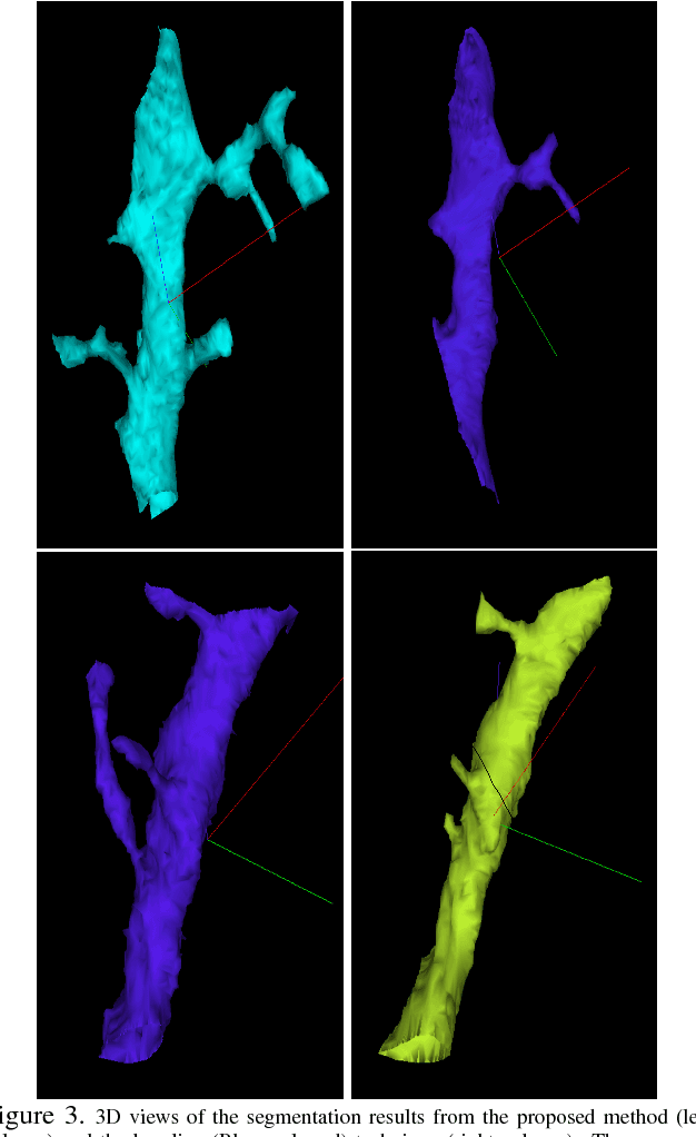 Figure 3 for Anisotropic EM Segmentation by 3D Affinity Learning and Agglomeration