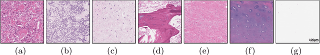 Figure 2 for Deep Interactive Learning: An Efficient Labeling Approach for Deep Learning-Based Osteosarcoma Treatment Response Assessment