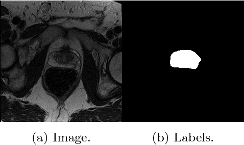 Figure 1 for Conditional Random Fields as Recurrent Neural Networks for 3D Medical Imaging Segmentation