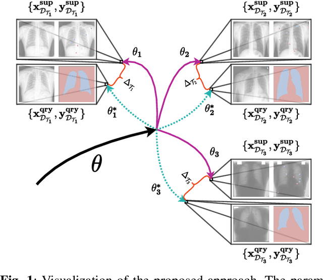 Figure 1 for Learning to Segment Medical Images from Few-Shot Sparse Labels