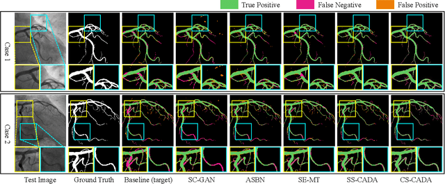 Figure 3 for Contrastive Semi-supervised Learning for Domain Adaptive Segmentation Across Similar Anatomical Structures