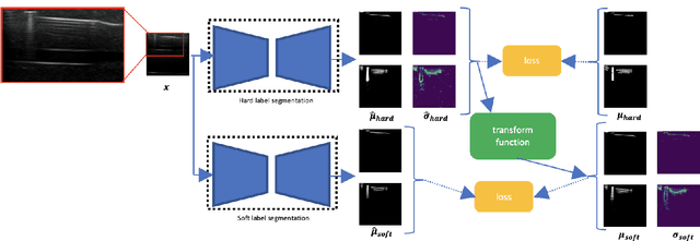 Figure 2 for Weakly- and Semi-Supervised Probabilistic Segmentation and Quantification of Ultrasound Needle-Reverberation Artifacts to Allow Better AI Understanding of Tissue Beneath Needles