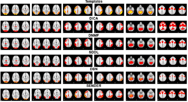 Figure 2 for SENDER: SEmi-Nonlinear Deep Efficient Reconstructor for Extraction Canonical, Meta, and Sub Functional Connectivity in the Human Brain