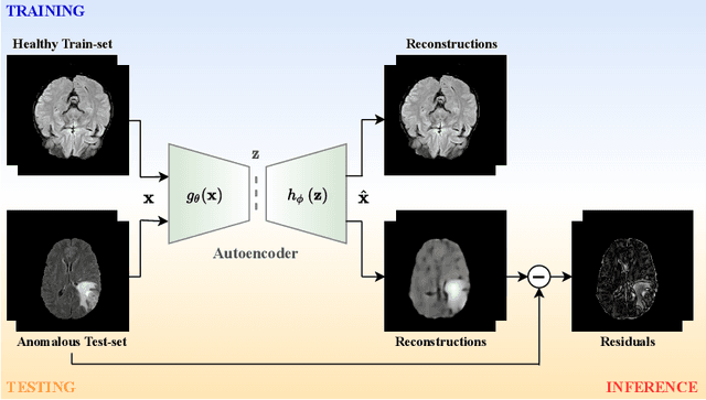 Figure 3 for Transformer based Models for Unsupervised Anomaly Segmentation in Brain MR Images