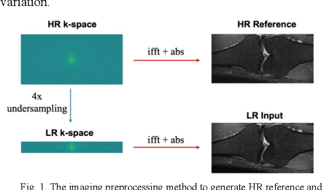 Figure 1 for Magnitude-image based data-consistent deep learning method for MRI super resolution